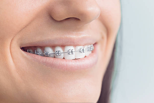 Best Traditional Braces  in Pistakee Highlands, IL